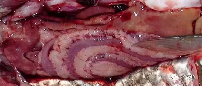 腸炎.jpg 腸炎.jpg