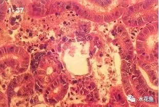 腎造血組織壞死.jpg 腎造血組織壞死.jpg